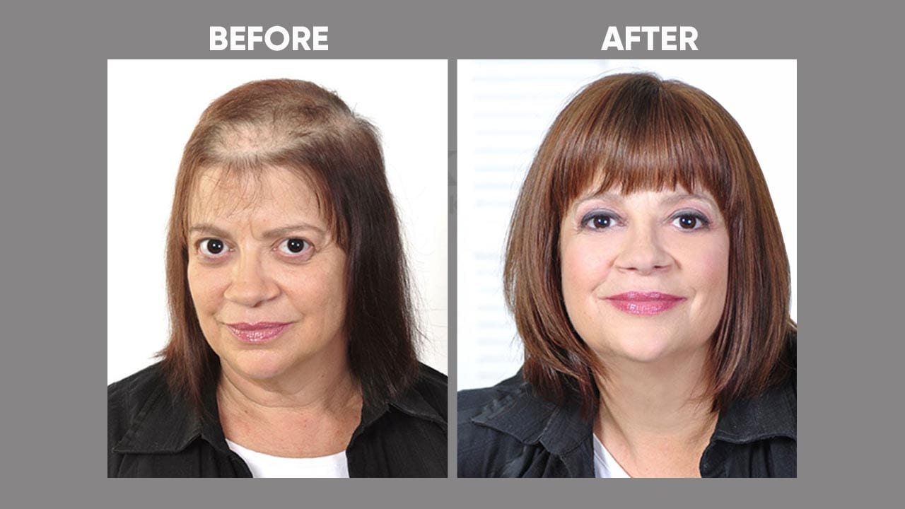 Hair wig rajkot hotsell
